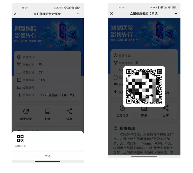 影像报告扫码可见 众阳健康助力医院进入“云胶片”时代